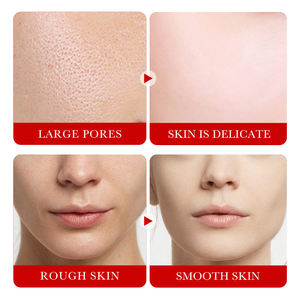 OEM SADOER Marque Privée – Coffret Soin à la Grenade Rouge : Sérum, Nettoyant, Crème, Tonique, Crème Contour des <span class=keywords><strong>Yeux</strong></span>, Lotion Hydratante et Éclaircissante - Product Image 4