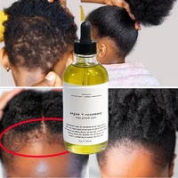 Traitement Capillaire à l'Huile de Romarin Bio aux 12 Herbes et Noix du Maroc, Élixir Naturel de Longévité, Puissant Accélérateur de Croissance