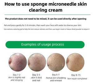 Krim Pengelupas Alga Perawatan Penghilang Flek Hitam, Bintik, Melasma, dan Hiperpigmentasi Wajah - Product Image 2