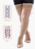 Bas de contention mi-cuisses respirants en nylon et élasthanne pour femmes, antidérapants, épaisseur moyenne, compression 15-20 mmHg, classe 1, qualité médicale