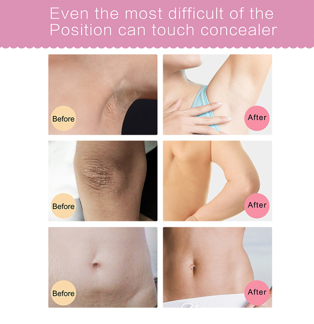 Amazon Hot Sale Underarm Whitening Cream Armpit Leg Knee Private Parts Brightening Melanin Remover Black Skin Whitening Cream