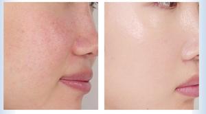 ผง99% บริสุทธิ์วิตามิน B8ธรรมชาติสนับสนุนอารมณ์ - Product Image 6