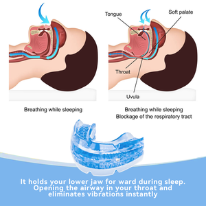 Protège-dents anti-grincement <span class=keywords><strong>de</strong></span> dents réglable pour le sommeil, plusieurs couleurs, protège-dents anti-grincement <span class=keywords><strong>de</strong></span> dents pour la <span class=keywords><strong>nuit</strong></span>, dispositif anti-ronflement - Product Image 4