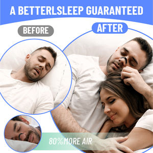 Dilatador <span class=keywords><strong>Nasal</strong></span> Magnético con LOGO Personalizado para Respirar Mejor Tiras Nasales a Granel de Colores - Product Image 4