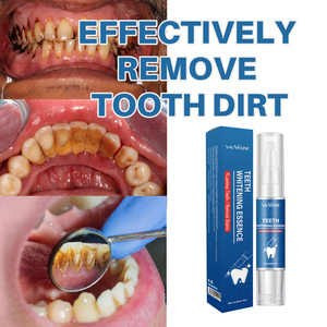 Penna Sbiancante per <span class=keywords><strong>Denti</strong></span> Senza Perossido, 4ml, per <span class=keywords><strong>Denti</strong></span> Sensibili, Uso Domestico, Etichetta Privata, Vendita all'Ingrosso - Product Image 2