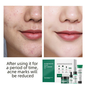 Ensemble de Soins de Beauté Éclaircissants et Anti-Âge Unisexe pour Adulte au Niacinamide, Glycérine et Silicone pour Visage - Fourniture FEO - Product Image 5