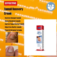 Crème naturelle à base de plantes pour l'élimination des mycoses des ongles, pommade anti-infectieuse pour les soins des mains, des pieds et du corps, en gros
