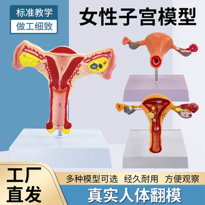 Modelos anatómicos para la enseñanza de las alteraciones patológicas del útero y los ovarios; modelos de anatomía reproductiva interna femenina. - Product Image 1