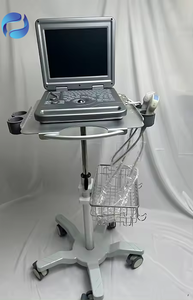 Sistema de Ultrasonido Digital Completo para Examen de Salud Animal, <span class=keywords><strong>Precio</strong></span> Directo de Fábrica - Product Image 4