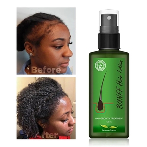 Organic Nourishing Hair <strong>Regeneration</strong> <strong>Scalp</strong> Care Massage Essential Oil Hair Growth &amp; Damaged Hair Repair Natural Hair Spray - Product Image 2