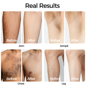 Dispositivo Portátil 3 en 1 para Rejuvenecimiento de la Piel con Luz Pulsada Intensa (IPL), Depilación Láser con Enfriamiento, Máquina Depiladora IPL para Hombres - Product Image 5