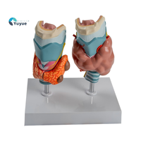 Modèle d'anatomie pathologique thyroïdienne médicale pour l'enseignement et la démonstration