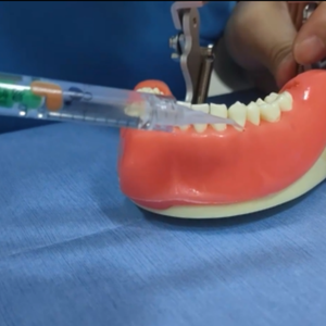 ईसोनिक्स पेरोडोंटल-विशिष्ट मौखिक जीवाणु जेल ट्यूब/बॉक्स उपचार के लिए मौखिक - Product Image 4