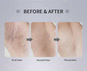Producto de Tendencia 2026, Máquina de Depilación Láser de Diodo de 808nm, Enfriamiento con Hielo, Depiladora Permanente Indolora, Cepillo de Limpieza Facial - Product Image 6