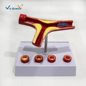 Modelo de Aterosclerosis y Trombosis de Arterias Cardiovasculares, Modelo de Obstrucción Patológica de Vasos Sanguíneos - Product Image 4