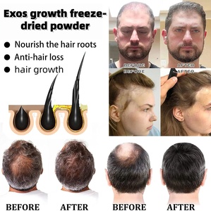 เซรั่มเซลล์ต้นกำเนิดเอ็กโซซีส 2 พันล้านเซลล์ EXOS สำหรับบำรุงเส้นผม ฟื้นฟู บำรุงรากผม กระตุ้นการงอกใหม่ แก้ปัญหาผมร่วง ผมบาง - Product Image 4