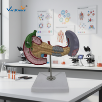 Modelo de anatomía del cuerpo humano, enfermedades del páncreas y la médula, modelo de enseñanza médica patológica