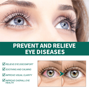 Rodillo de <span class=keywords><strong>Tratamiento</strong></span> Visual South Moon Ophthal Care, Mejora la Claridad Visual, Alivia las Molestias Oculares, Potenciador de la Visión - Product Image 5