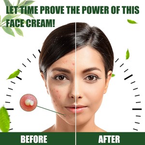 Crème <span class=keywords><strong>pour</strong></span> le visage South Moon Collagen Vitamine <span class=keywords><strong>hydratante</strong></span> anti-âge, anti-acné et anti-taches, éclaircissante et correctrice - Product Image 3