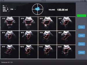 Scanner vétérinaire <span class=keywords><strong>portable</strong></span> haute précision pour la vessie, mini-sonde 4D sans fil, échographe vésical - Product Image 6