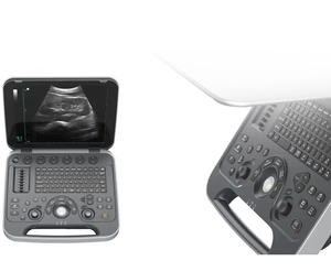 Độ nét cao xách tay siêu âm thú y máy với siêu âm DOPPLER Màu màn hình lớn cụ cho chó sử dụng y tế - Product Image 6