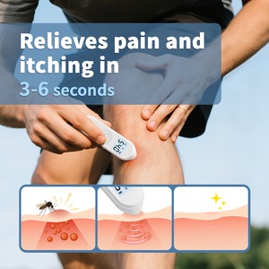 Aide aux piqûres d'insectes rechargeable Soulagement des piqûres d'insectes Design compact Soulagement des piqûres pour les démangeaisons et le gonflement Vente en gros d'usine OEM - Product Image 4