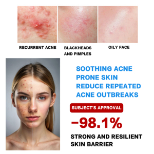 Crème à la vitamine C ROUSHUN en marque propre, 7 jours, pour un teint uniforme, blanchissant supplémentaire, éclatant et nourrissant - Product Image 3