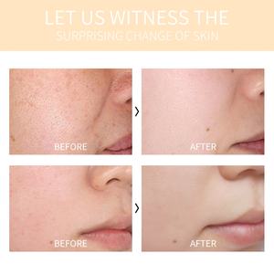 Sérum Visage Anti-Âge en Gros au Squalane 1% – Atténue les Taches et Rajeunit la Peau - Product Image 6