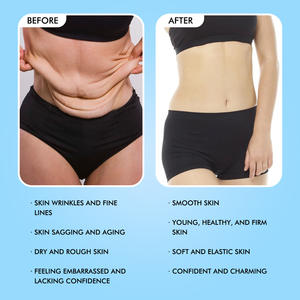 2024 Venta caliente nd reafirmante crema de mantequilla juvenil Etiqueta Privada orgánica cuerpo celulitis Crema para estrías - Product Image 6