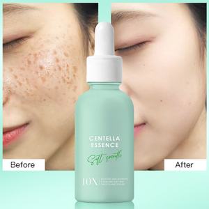 Sérum Réparateur Naturel à la Centella pour Peaux Sensibles, Traitement Anti-Acné, Soin Apaisant, Essence Faciale – Vente en Gros OEM Marque Privée - Product Image 3