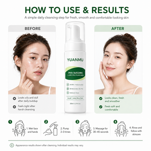 Tratamiento para el Acné con Ácido PHA, Ácido Succínico, Niacinamida, Zinc PCA, Limpiador Facial Espumoso Clarificante de Bajo pH, Equilibra la Oleosidad - Product Image 6