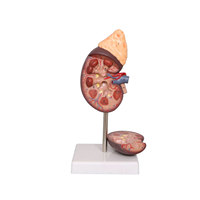 DARHMMY Modelo Anatómico de Riñón Humano de Tamaño Real para Educación Médica, Material de PVC
