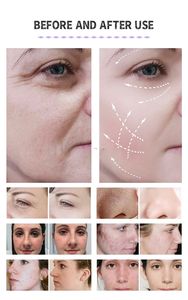 Vente directe - Nettoyage du visage multifonctionnel 8 en 1 - Hydro-jet d'eau et d'oxygène - Analyse de la peau - Microdermabrasion - Soins du visage en spa - Product Image 5