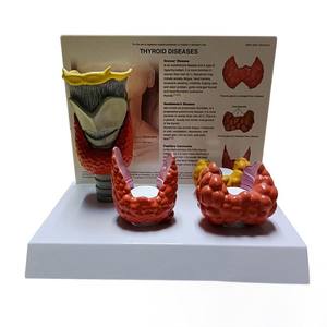 Tıbbi % Model beyin insan tiroid hastalığı anatomi modeli, endokrinoloji eğitimi için gerçekçi tiroid patoloji simülatörü - Product Image 5