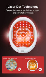 جهاز LLLT لنمو الشعر لمنع تساقط الشعر والتدليك الصحي لفروة الرأس بالليزر PDT بالأشعة تحت الحمراء ضوء أزرق أحمر عالي الطاقة جهاز نمو الشعر LLLT - Product Image 4