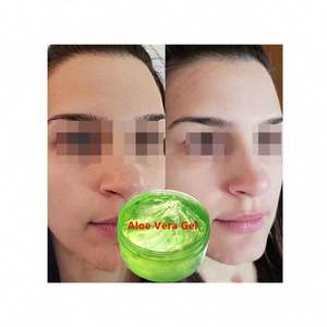 Gel d'aloe vera biologique apaisant pour le visage, hydratant pour les plantes, vente en gros, extrait frais d'aloe vera, gel exfoliant à l'aloe vera, direct - Product Image 1