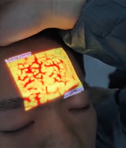 Yüz ameliyatı için VF12 pediatrik kan damarı bulucu/ven dedektörü/taşınabilir damar bulucu - Product Image 3