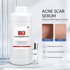 Crème PDRN puissante pour estomper les vergetures, lotion réparatrice post-partum pour la peau, atténue les cicatrices de grossesse - Product Image 1