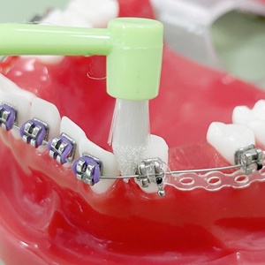 Sabedoria Dentes Implante Escova De Dente Ortodôntico Conjunto Único Ponto Feixe Ortodôntico Único Tuft Toothbrush - Product Image 4