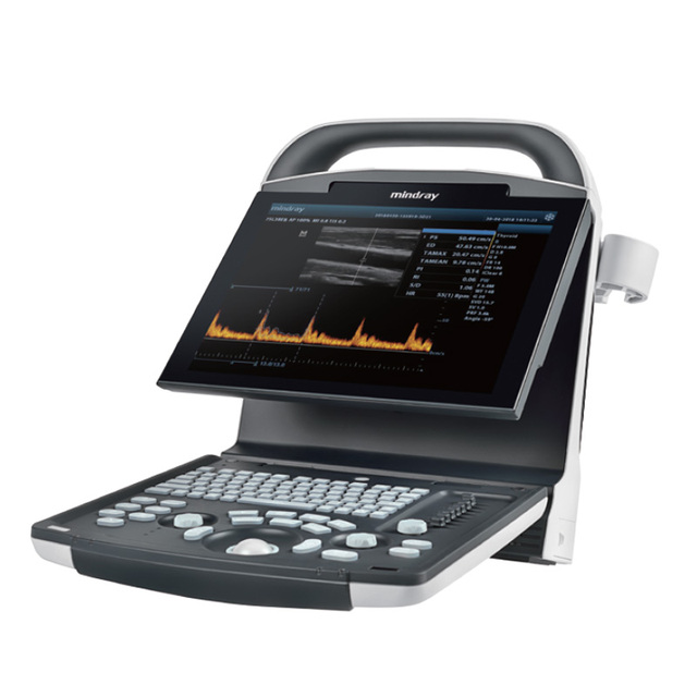 Mindray DP-10 Vet High-Image Quality Veterinary Ultrasound for Abdominal Cardiac Reproductive Exams