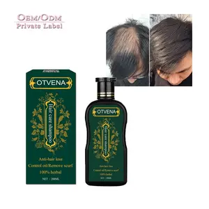 Groothandel Natuurlijke Haargroei Shampoo Haarverlies Organische Gember Shampoo Haargroei Shampoo Voor Mannen En Vrouwen