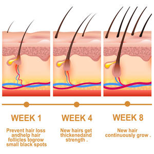 Venta al por mayor EELHOE harina de arroz soja grano de trigo extracción pérdida de cabello prevención arroz agua aceite esencial para el cabello - Product Image 4