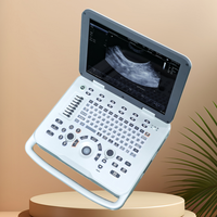 SONOIMAGE D20, excellent appareil d'échographie vétérinaire, certifié CE, adopte un écran haute définition de qualité supérieure pour les examens d'animaux.