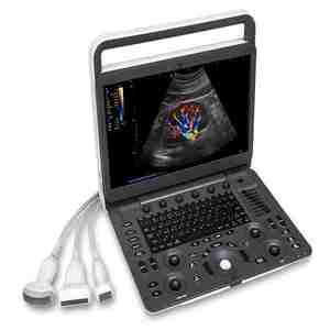 SonoScape E2V – Échographe Doppler Couleur Portable pour Usage Vétérinaire – Système d'Échographie Diagnostique pour Cliniques Vétérinaires – Prix - Product Image 2