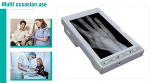 เครื่องตรวจจับเส้นเลือดแบบพกพาสำหรับสัตว์ - Product Image 6