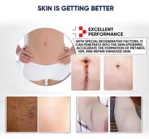 Aceite de masaje puro Eliminación de cicatrices Esencia de lavanda Elimina la decoloración Reparación de cicatrices en la piel Estrías Reparación de aceite esencial - Product Image 5