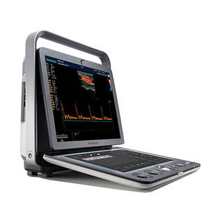 <span class=keywords><strong>Sonoscape</strong></span> <span class=keywords><strong>S8</strong></span> S9 Draagbare Kleur Doppler <span class=keywords><strong>Ultrasound</strong></span> <span class=keywords><strong>Machine</strong></span> Siterite Echografie, S9 Draagbare Kleur Doppler Systeem - Product Image 2
