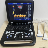 Sistem Ultrasound Digital K-C500 3D 4D Opsional Mesin USG Portabel Doppler Warna