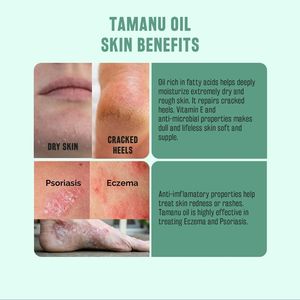 Huile de Tamanu de marque privée sans hexane pour prévenir l'apparition des boutons et réparer les peaux sèches rugueuses huile de Tamanu légère - Product Image 5