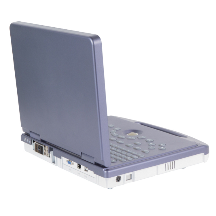 Professional Ultrasound Scanner Portable Ultrasound Scanner Maternity Pregnancy Diagnosis Ultrasound Scanner